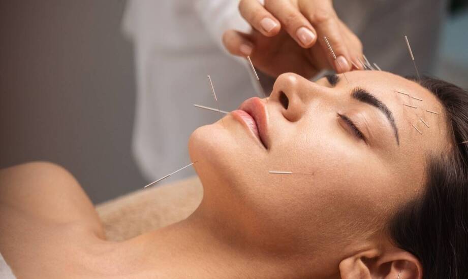 Akupunktura jako element terapii bólu głowy typu napięciowego