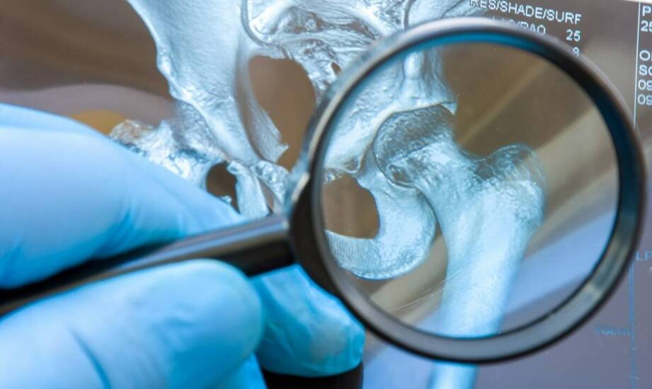 Osteoporoza – jak obrazowa diagnostyka wspiera leczenie?