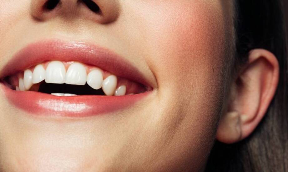 Co warto wiedzieć o pielęgnacji zębów po ortodontycznym leczeniu?