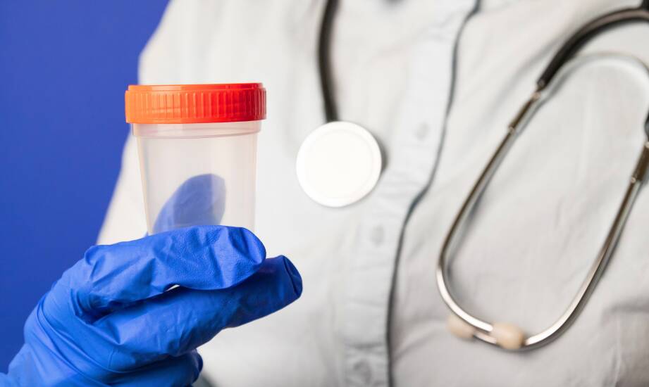 Aus welchen Werkstoffen werden Urinbecher hergestellt?