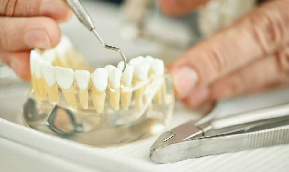 Skuteczność zębowych implantów w porównaniu do tradycyjnych protez