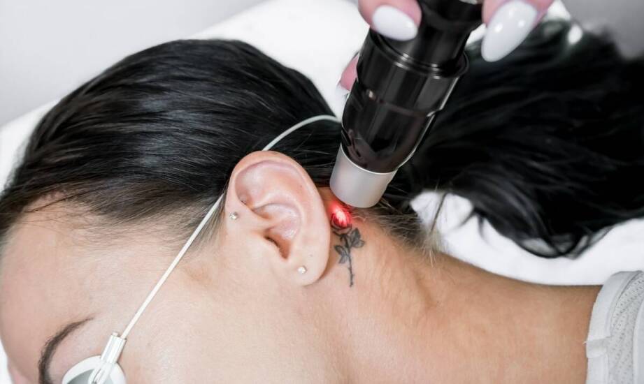 Czy laserowe usuwanie permanentnego makijażu wpływa na późniejsze kosmetyczne zabiegi?