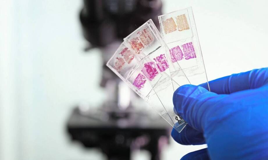 Wpływ niedoczynności przysadki na hormonalne zdrowie pacjenta