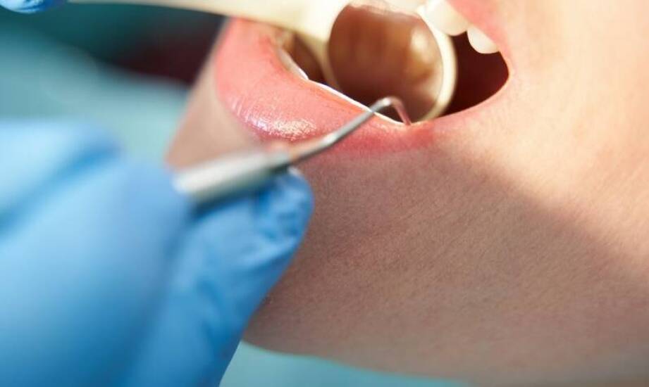 Procedury polerowania zębów a ich wpływ na wygląd i zdrowie szkliwa