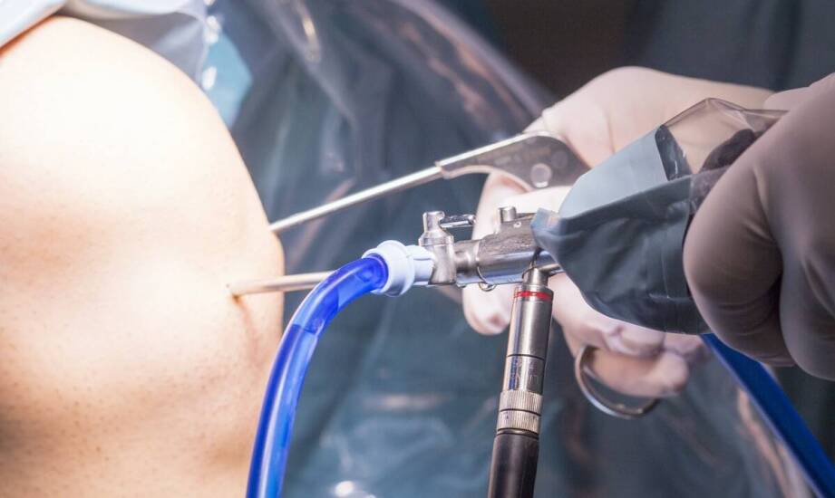 Jakie są możliwości leczenia barku z użyciem artroskopii?