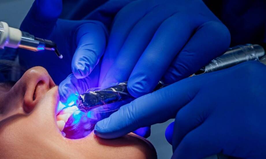 Jak injection flow zmienia standardy estetyki zębów w stomatologii?