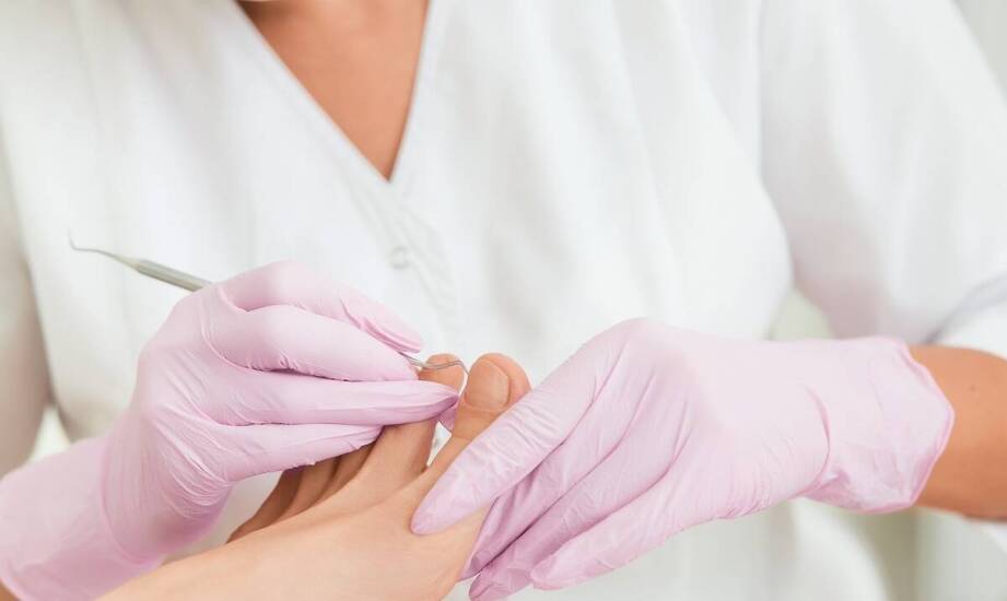 Kompleksowa opieka podologiczna a leczenie modzeli i odcisków