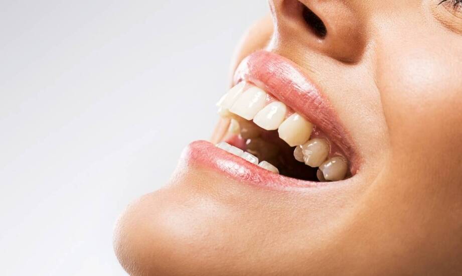 Estetyczne efekty porcelanowych licówek – co warto wiedzieć?