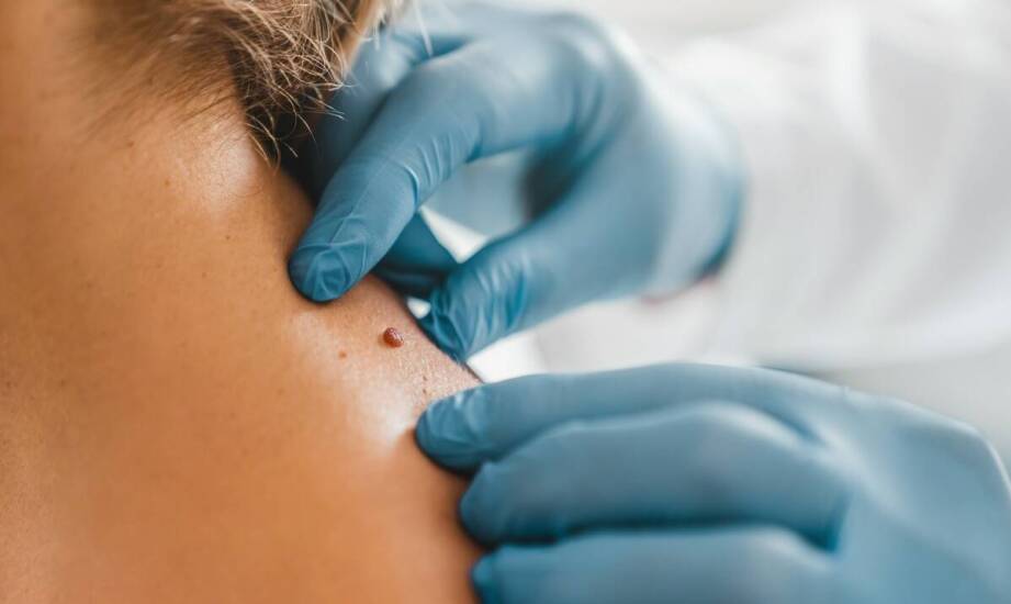 Jakie zabiegi są wykonywane w przypadku podejrzenia przednowotworowych zmian?