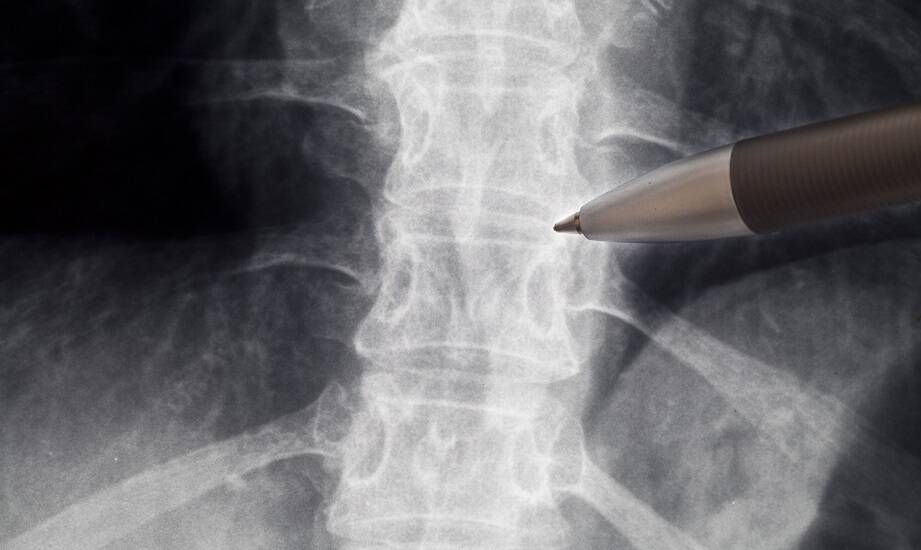 Znaczenie obrazowej diagnostyki w leczeniu schorzeń kręgosłupa