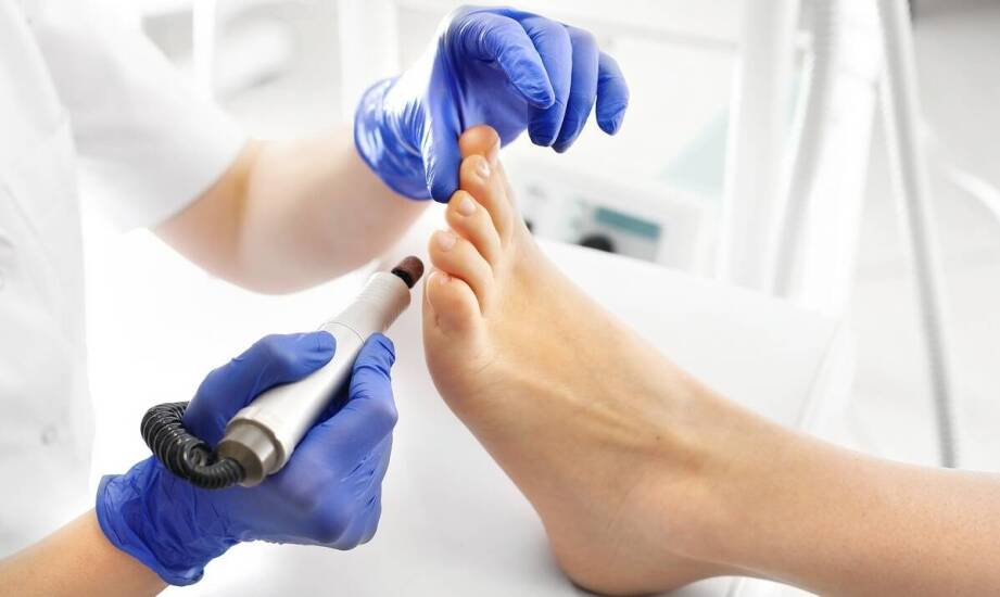 Nowoczesne rozwiązania w usuwaniu odcisków: co oferują specjaliści?