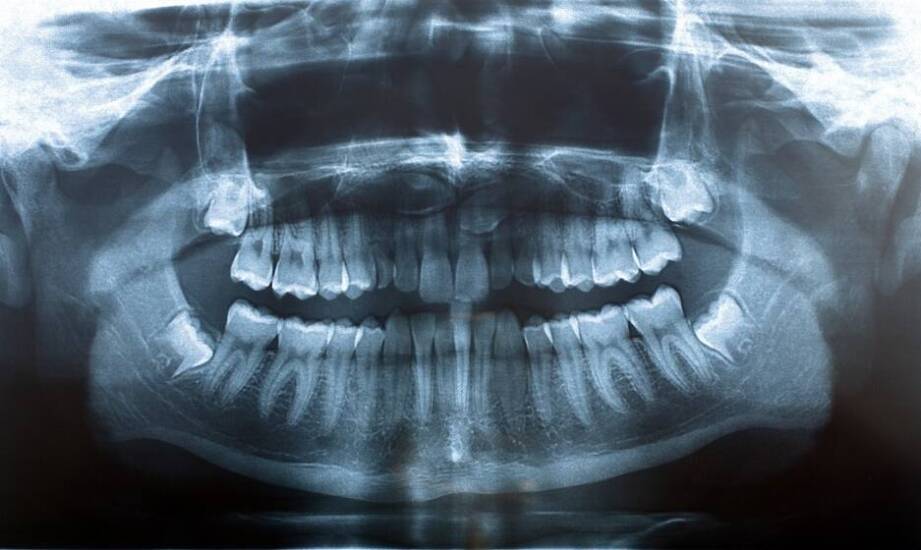 Rola zaawansowanej diagnostyki w leczeniu szczękowo-twarzowych wad