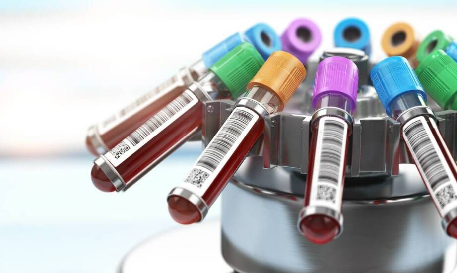 Cena wirówki do krwi a techniczne parametry – co wpływa na koszt zakupu?