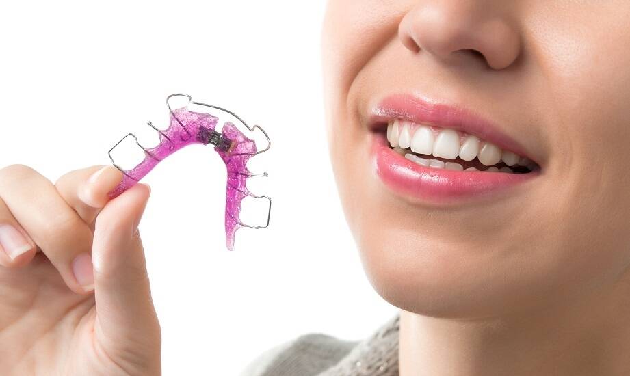 Jak długo trwa ortodontyczne leczenie i od czego to zależy?