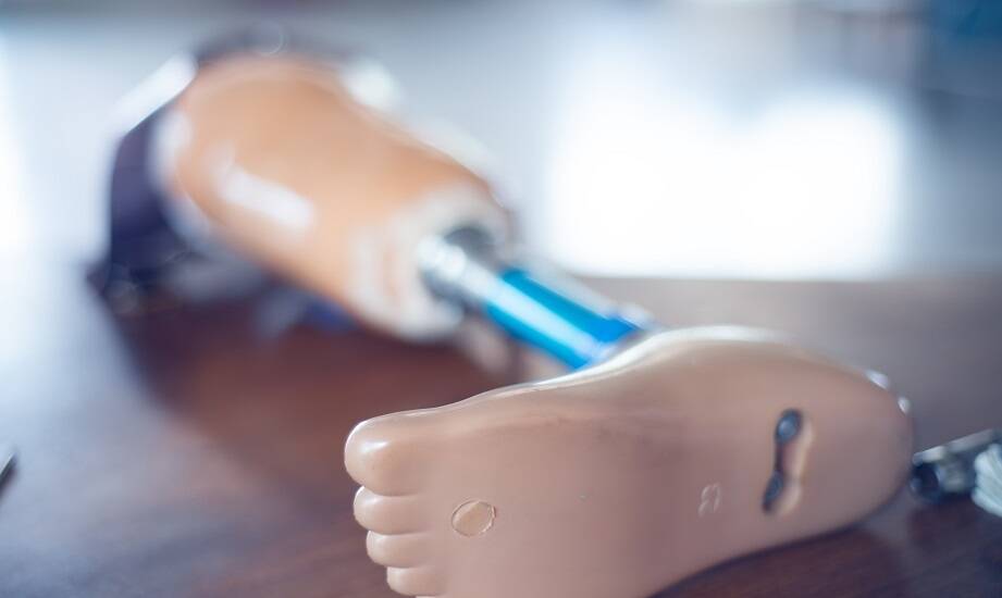 Jakie są różnice między tymczasowymi a stałymi protezami nogi?