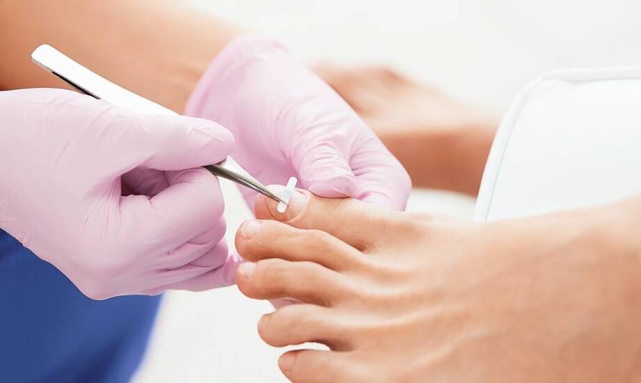 Jakie korzyści przynosi pedicure dla osób z cukrzycą?