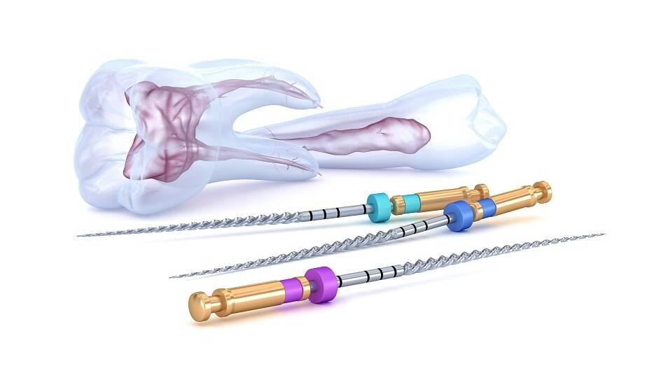 Skuteczność leczenia kanałowego: Rola mikroskopu w nowoczesnej endodoncji