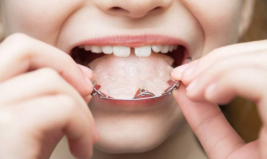 Czym różni się ortodontyczne leczenie dzieci i dorosłych?