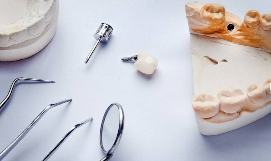 Jak leczenie kanałowe wpływa na trwałość zębowej korony?