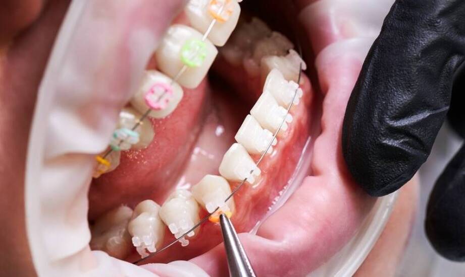 Rola ortodoncji w leczeniu wad zgryzu: co warto wiedzieć?