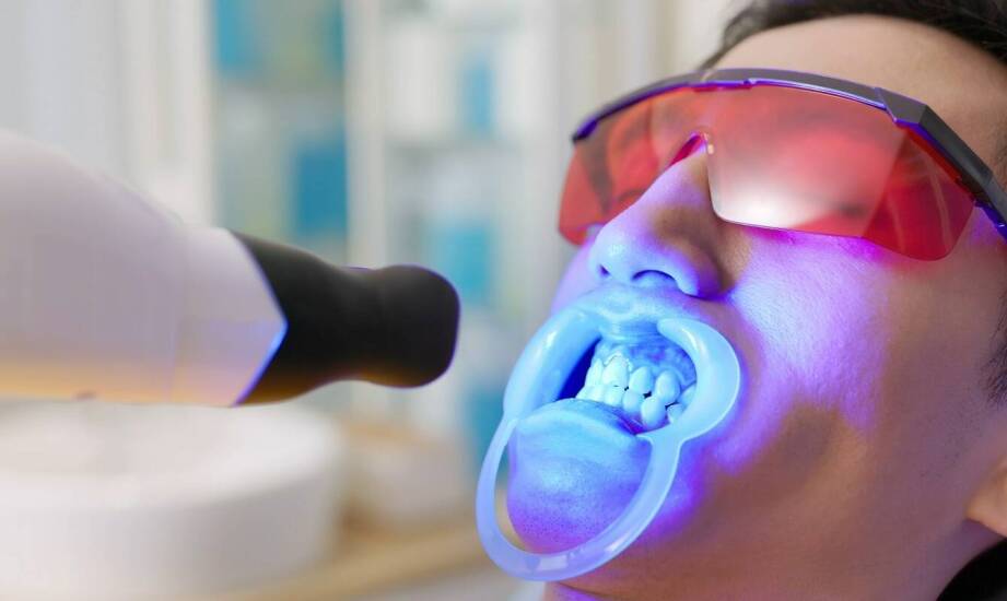 Wybielanie zębów jako element kompleksowego leczenia stomatologicznego
