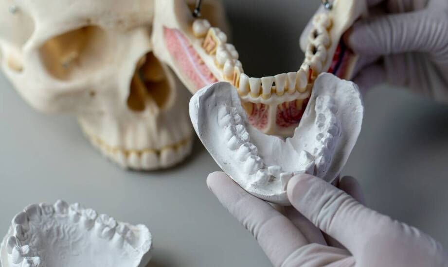 Proces zakładania protetycznych mostów – krok po kroku