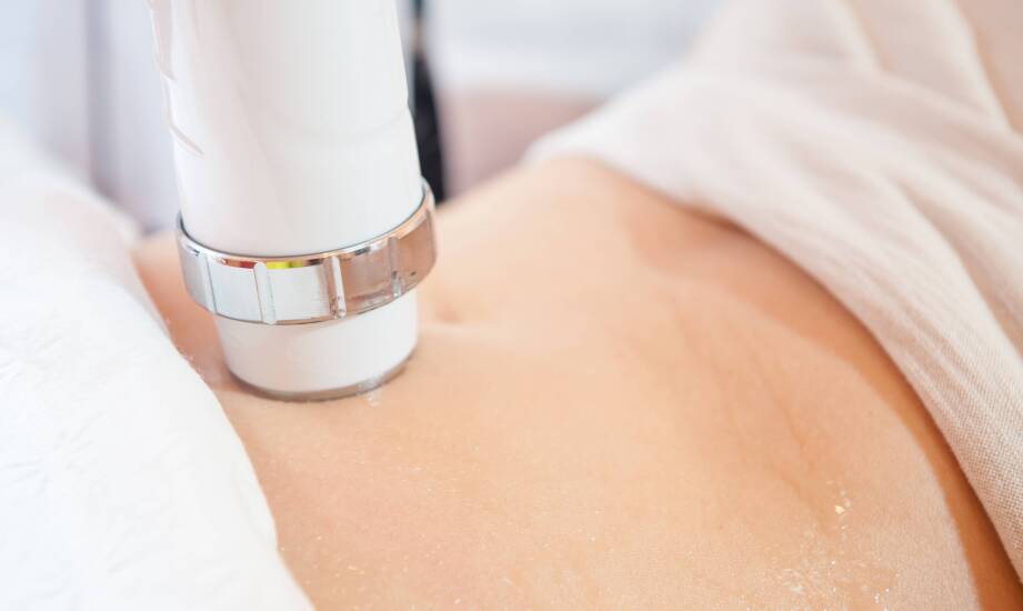 Dlaczego kobiety wybierają iniekcyjną lipolizę do modelowania bioder?