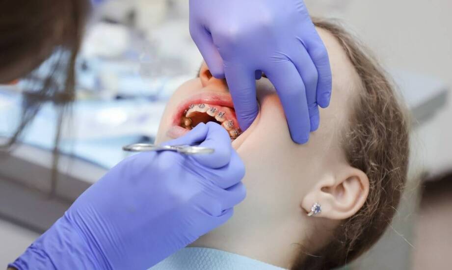 Jak dziecięca stomatologia wspiera korektę wad zgryzu u dzieci?