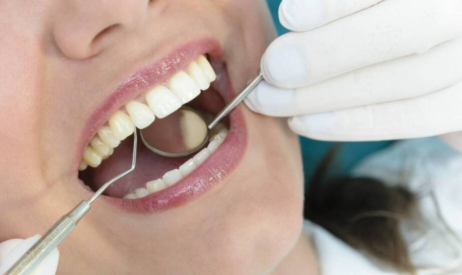Jak usuwanie nazębnego kamienia wpływa na świeżość oddechu?
