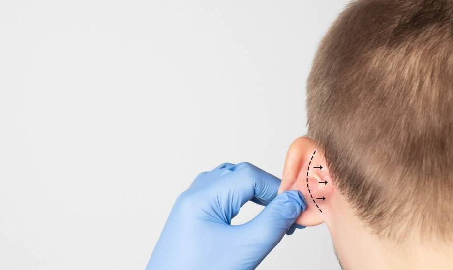 Plastyka uszu – jak poprawia komfort życia u pacjentów?