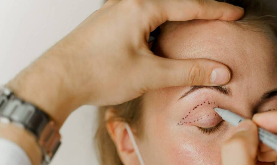 Czego unikać po zabiegu plastyki powiek, aby uzyskać najlepsze efekty?