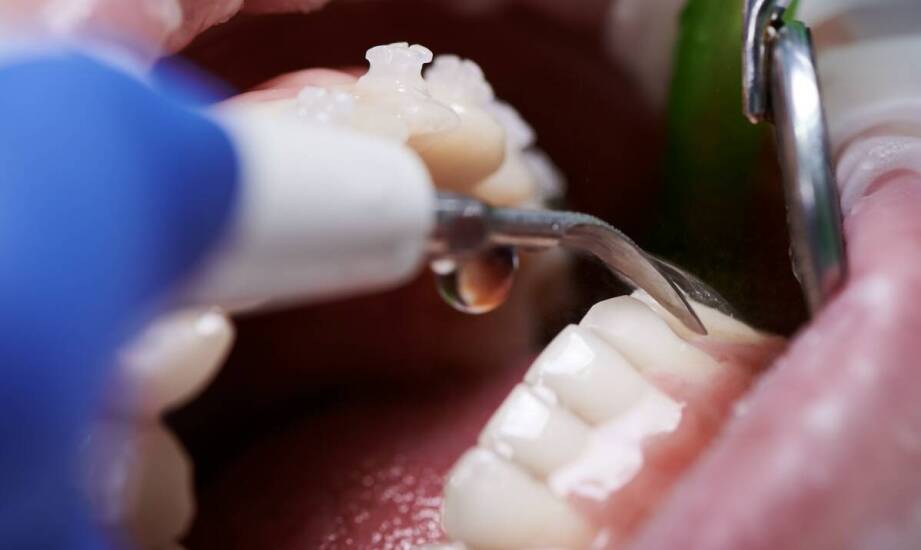 Jakie estetyczne zabiegi można wykonać na ostrym dyżurze stomatologicznym?