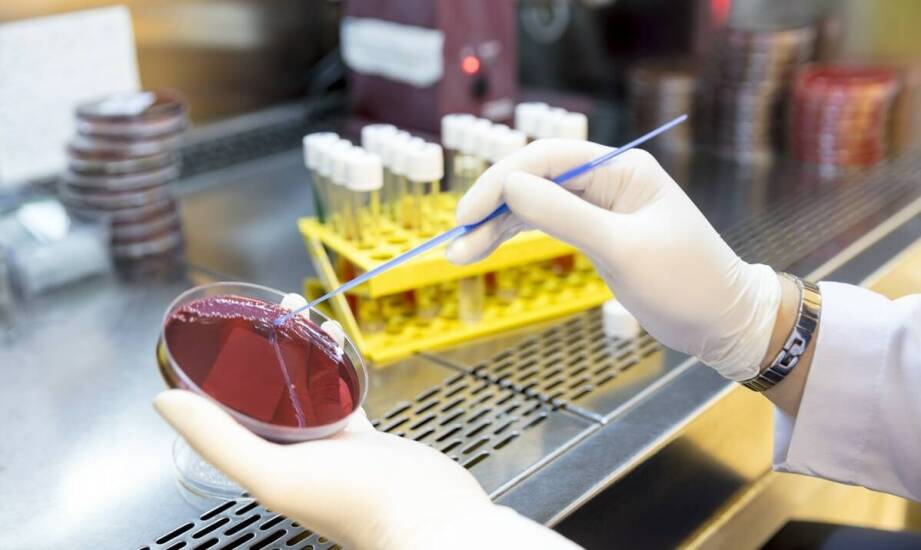 Badania na grzybicze infekcje: kompleksowa diagnostyczna oferta