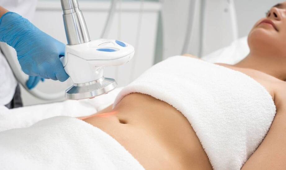 Czy karboksyterapia jest skuteczna w walce z rozstępami?