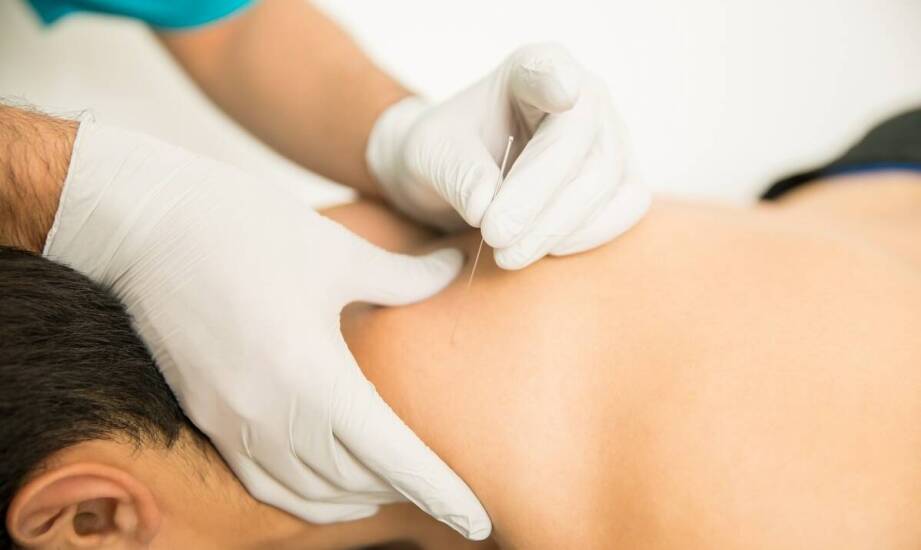 Skuteczność suchego igłowania w redukcji mięśniowego bólu