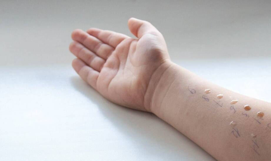 Jakie są wskazania do usunięcia znamienia u dzieci?