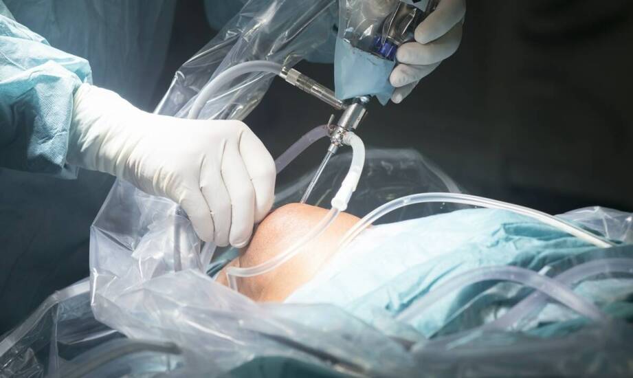 Chirurg w Łodzi: Zastosowanie laparoskopii w leczeniu przepuklin brzusznych