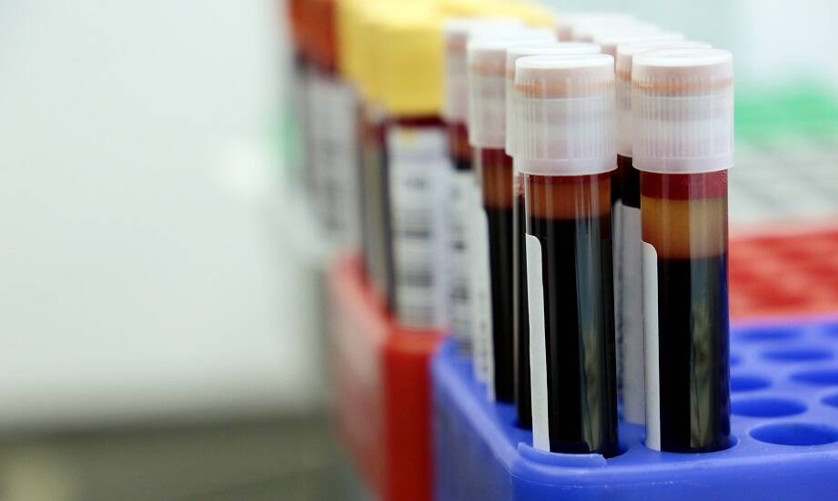 Diagnostyka laboratoryjna a zdrowie układu krążenia: badania, które mogą uratować życie.