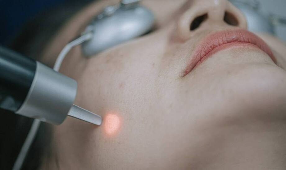 Jak długo utrzymują się efekty odmładzania za pomocą lasera CO2?