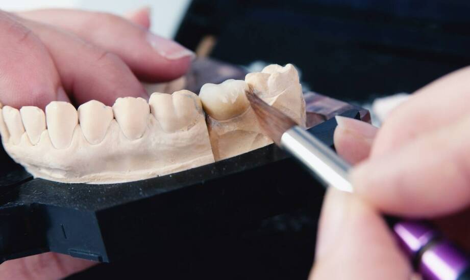 Zalety stosowania porcelanowych koron w estetycznej stomatologii