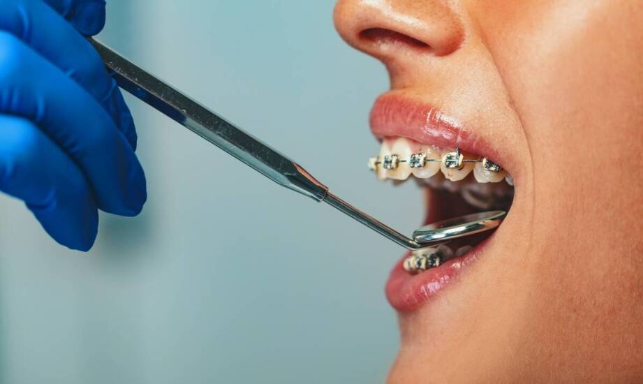 Mosty protetyczne: jakie korzyści przynoszą użytkownikom?