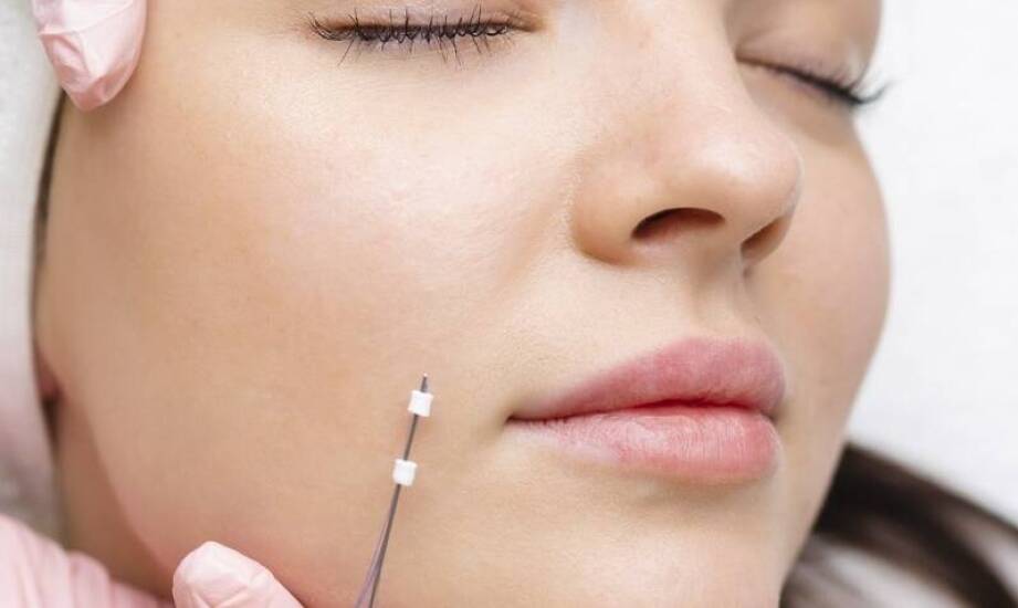 Igłowa mezoterapia jako metoda stymulacji produkcji kolagenu