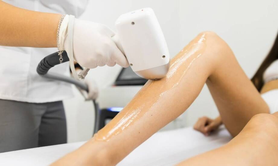 Jak przebiega proces laserowej depilacji krok po kroku?