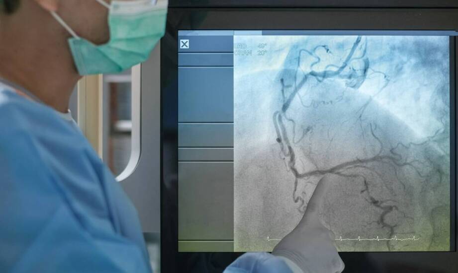 Chirurg naczyniowy a kompleksowa opieka nad pacjentem z miażdżycą.