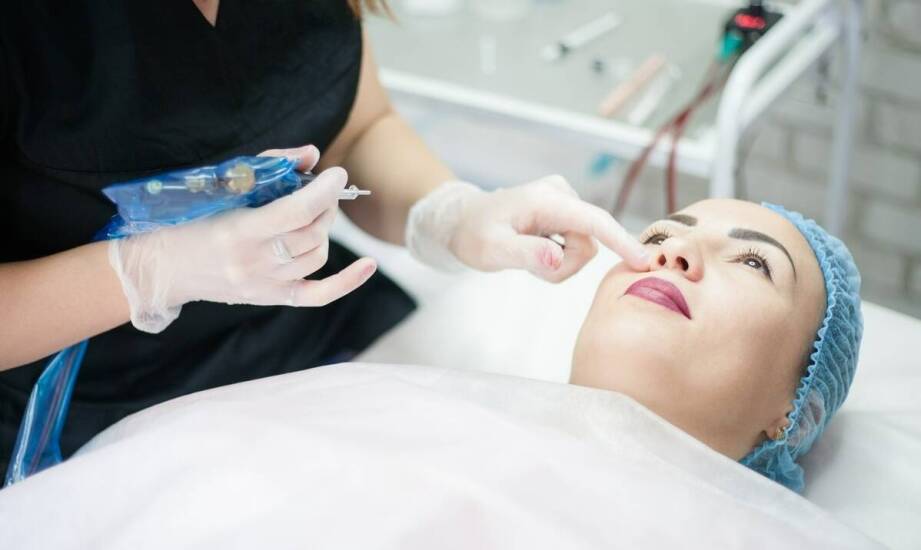 Przeszczep tłuszczowej tkanki jako metoda redukcji zmarszczek