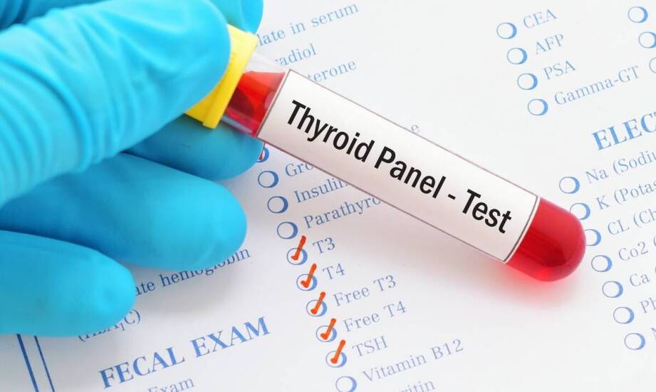 Rola laboratoryjnych badań w ocenie funkcji tarczycy