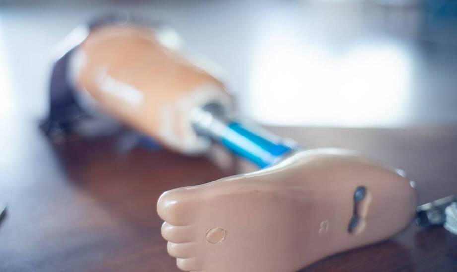 Jakie są różnice kosztowe pomiędzy protezami całej stopy a protezami częściowymi?