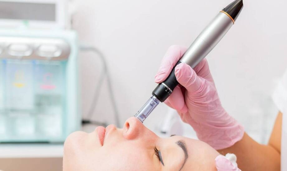 Skuteczność mezoterapii mikroigłowej w redukcji cieni pod oczami