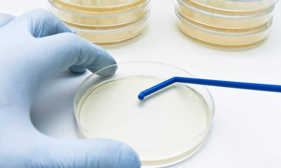 Sterylne szalki Petriego w badaniach nad komórkowymi kulturami