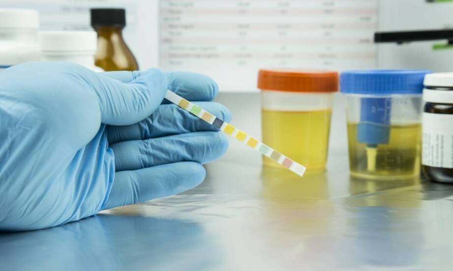 Różnice między tradycyjnymi a szybkimi testami ureazowymi: co warto wiedzieć?